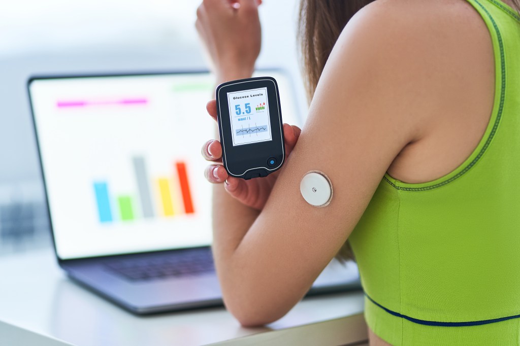 , die ein Glukosemessgerät in der Nähe eines tragbaren Glukosemessgeräts am Arm hältPoint-of-Care