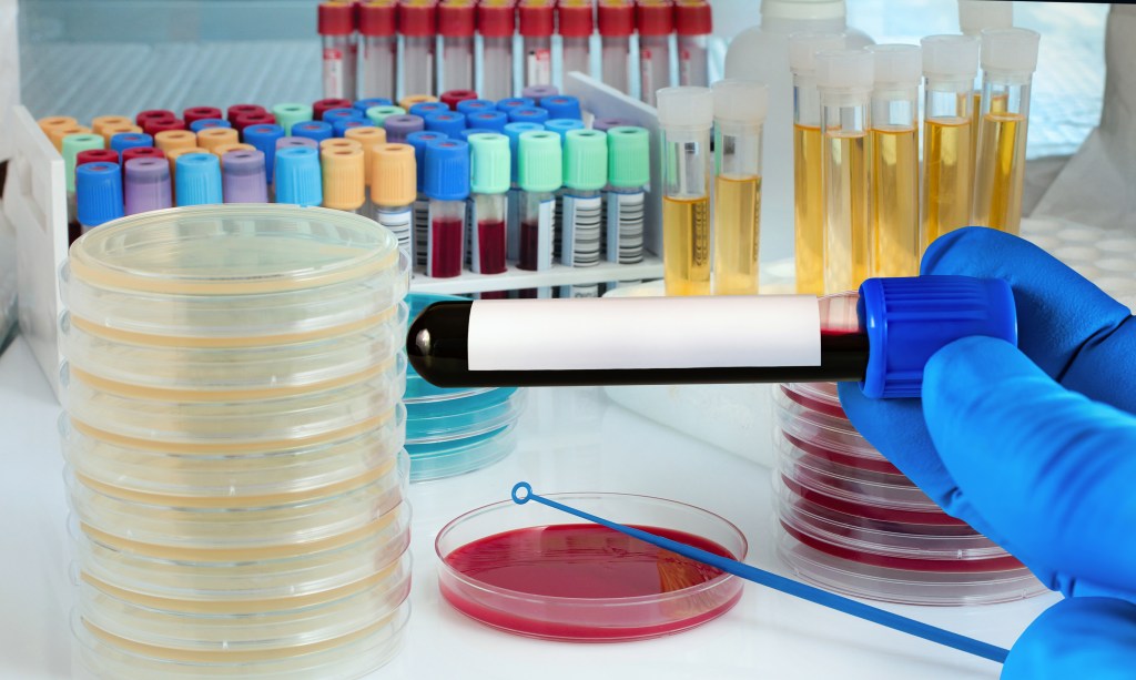 Different types of lab samples grouped on a table