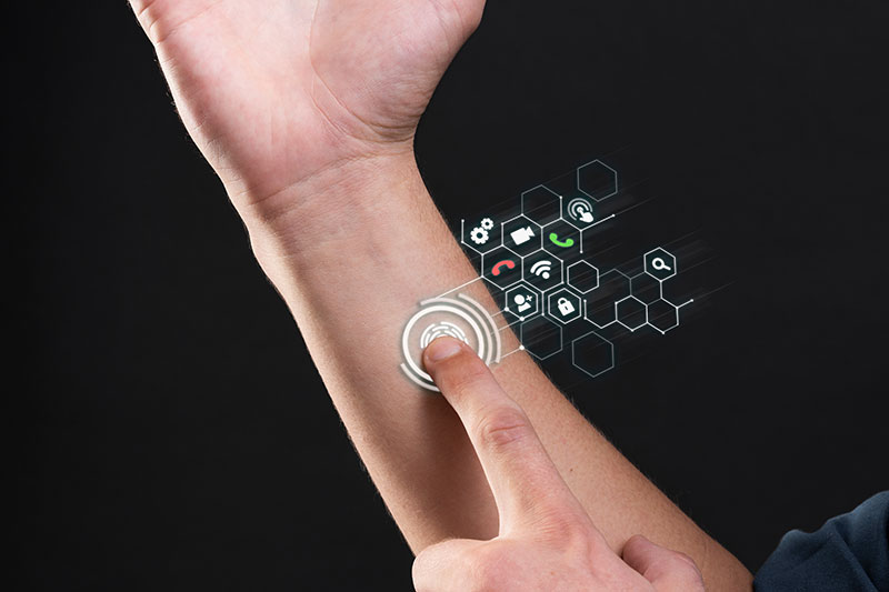 arm-patch-technology